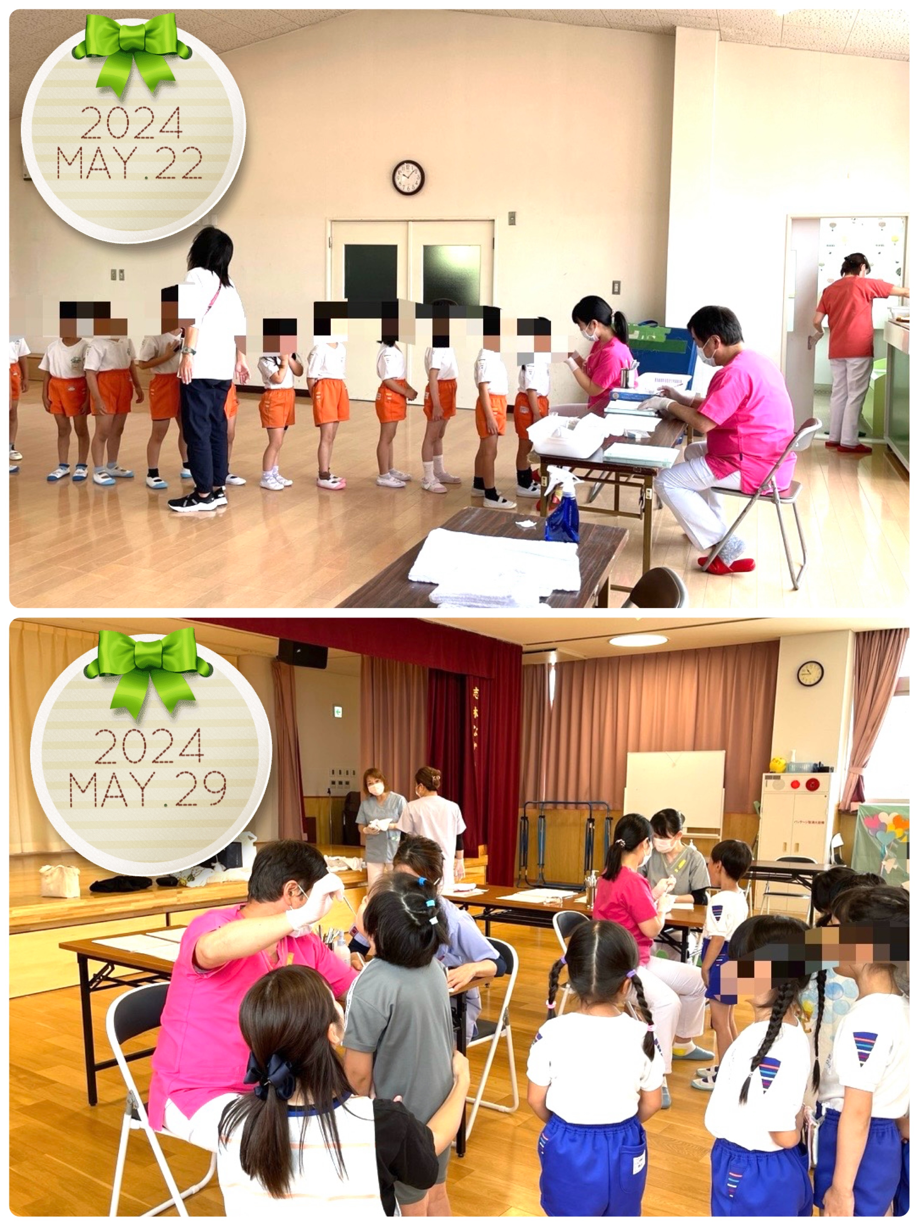 《ブログ》幼稚園の歯科検診2024の写真(埼玉県志木市)